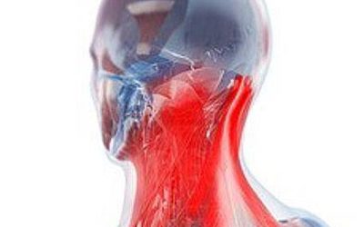 Nyakfájdalom kezelése
