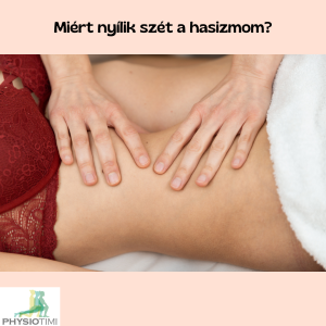 szétnyílt hasizom, rectus diastasis