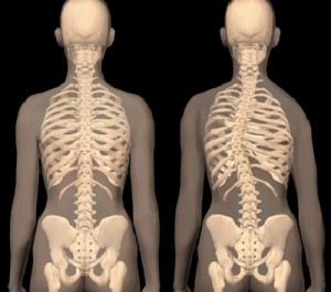 spine treatment Budapest